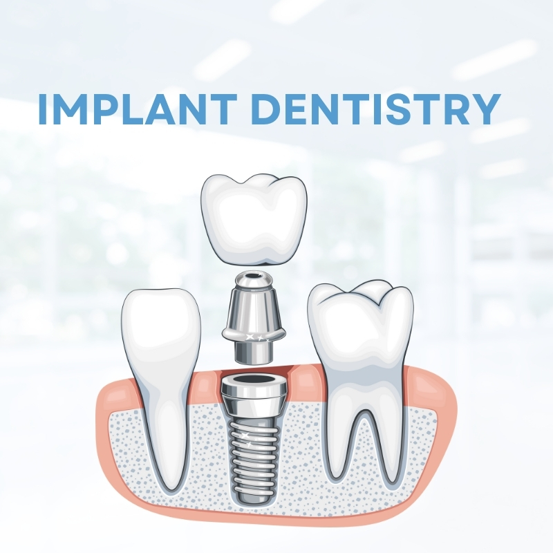 Implant dentistry