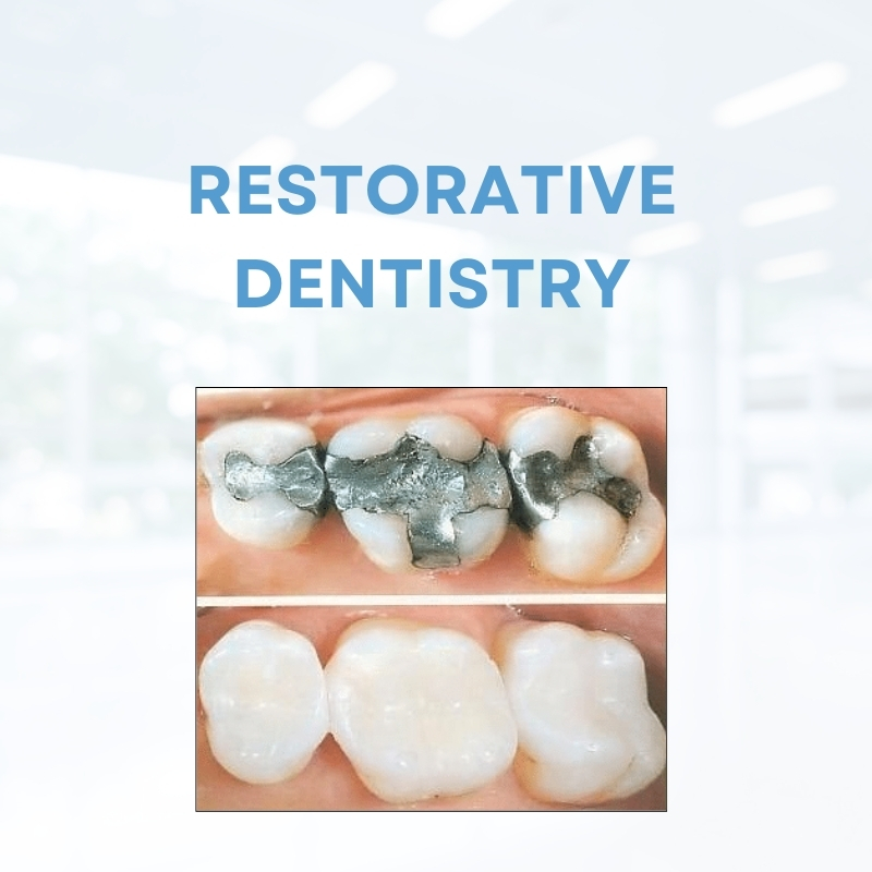 Restorative dentistry