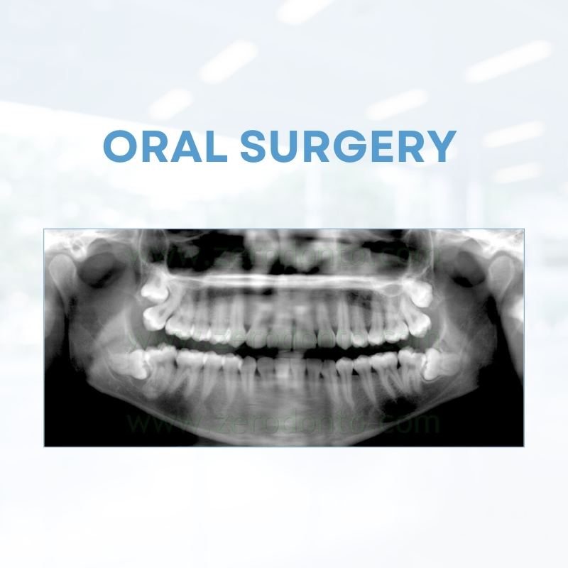 Oral surgery